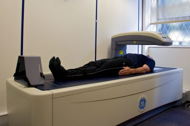 DEXA (Bone Density)