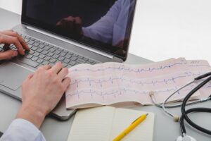 ECG