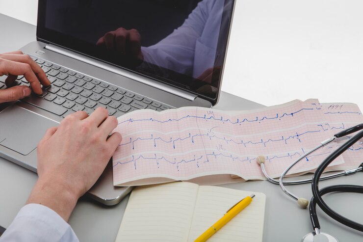 ECG
